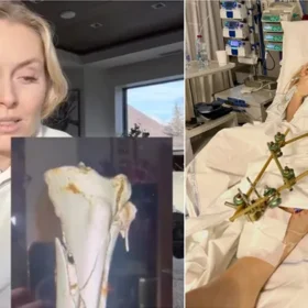 Линдси Вонн могла лишиться ноги после падения на Олимпиаде-2026