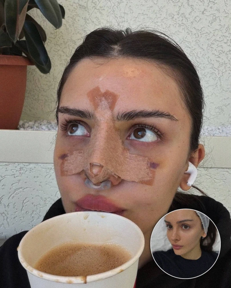 Дина Саева до и после изменений внешности