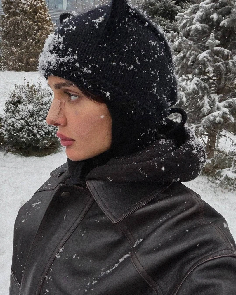 Дина Саева до и после изменений внешности