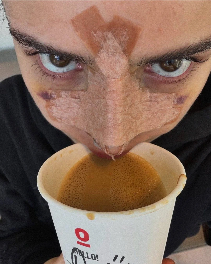 Дина Саева до и после изменений внешности